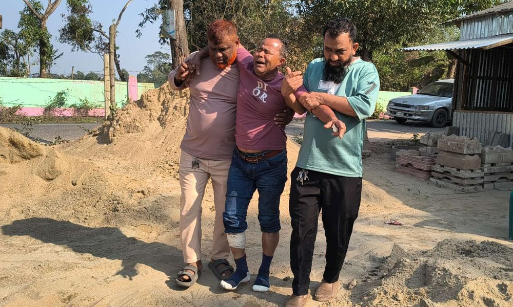 চাঁদার টাকা না পেয়ে গ্রিসপ্রবাসীর পা ভেঙে দেওয়ার অভিযোগ