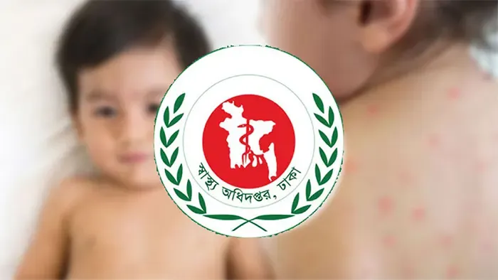 সিলেটে হাম ও উপসর্গ নিয়ে ৭ শিশুর মৃত্যু